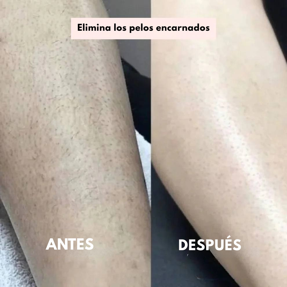 Flexienna™ – Recortadora 2-en-1 para Bikini & Cuerpo